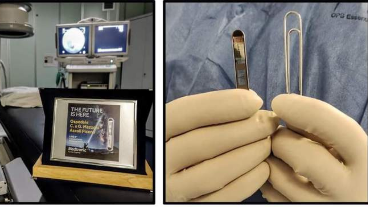 Ascoli Piceno, primo impianto di LINQ II un mini dispositivo per controllare il cuore